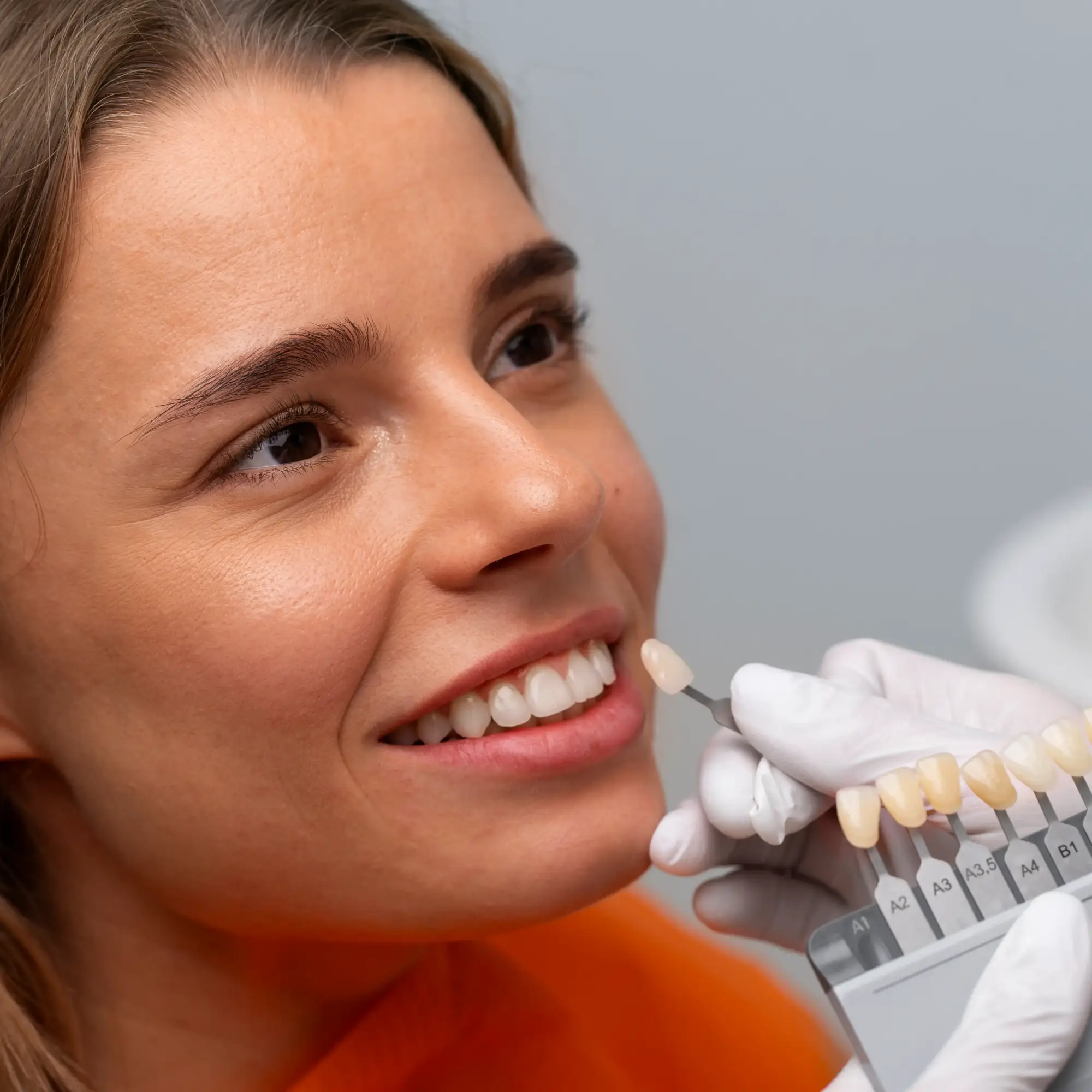 Lentes de Contato Dentais